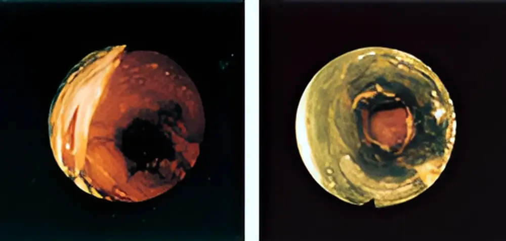 赤水対策 比較写真